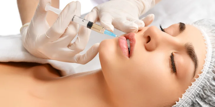 Výplň kyselinou hyalurónovou vo Vivacy anti-aging centre