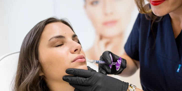 Výplň kyselinou hyalurónovou vo Vivacy anti-aging centre