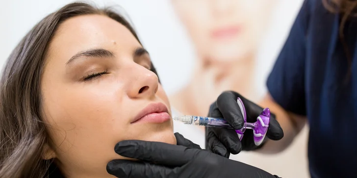 Výplň kyselinou hyalurónovou vo Vivacy anti-aging centre