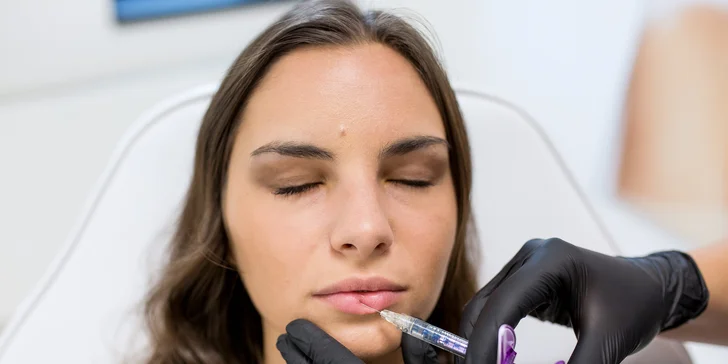 Výplň kyselinou hyalurónovou vo Vivacy anti-aging centre