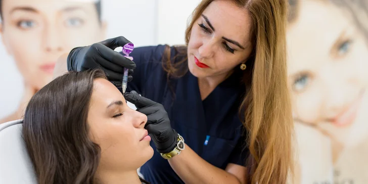 Výplň kyselinou hyalurónovou vo Vivacy anti-aging centre
