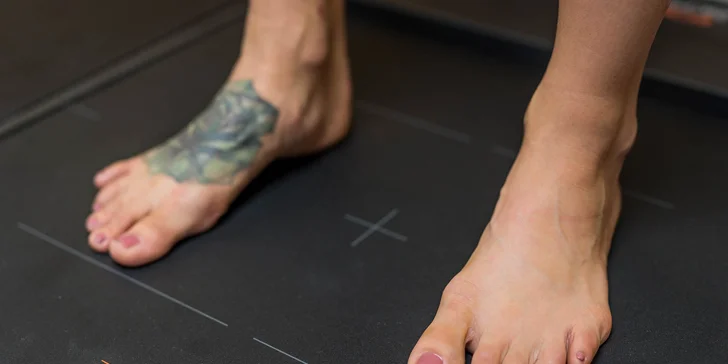 Diagnostika chodidla pomocou 3D laserfootscanu či posturálna diagnostika