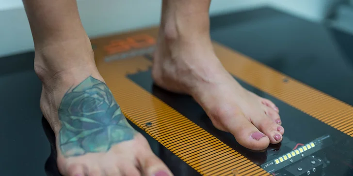 Diagnostika chodidla pomocou 3D laserfootscanu či posturálna diagnostika