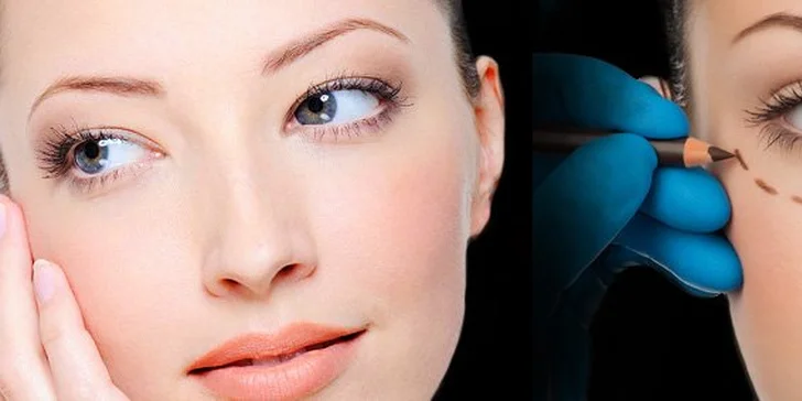 205 eur za blepharoplastiku - plastickú operáciu viečok. Ozajstný vianočný darček pre vašu krásu, so zľavou 50%!