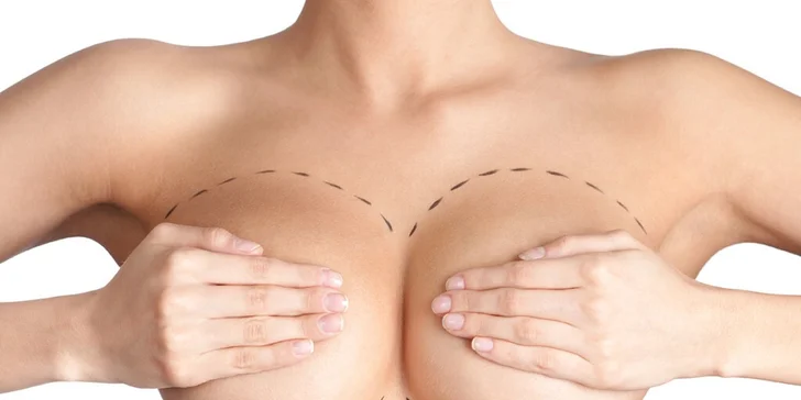 Profesionálne zväčšenie poprsia silikónovými implantátmi v Scarlett Clinic