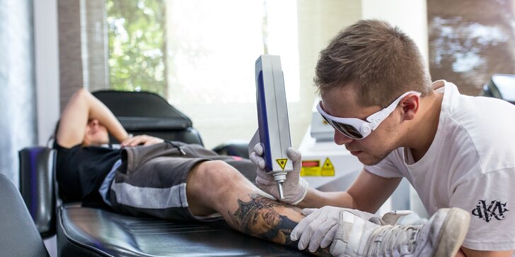 Odstránenie tetovania laserom aj so zľavou 30 % na pretetovanie