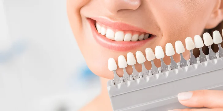 All inclusive balíček starostlivosti o zuby: dentálna hygiena + bielenie