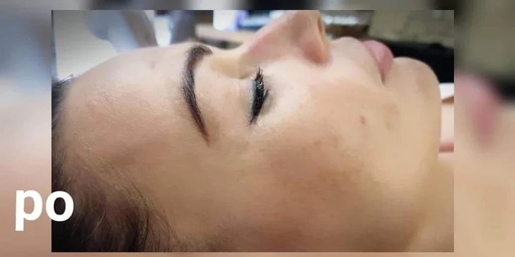 Najvyhľadávanejšie ošetrenie pre krásnu a zjednotenú pleť BB Glow!