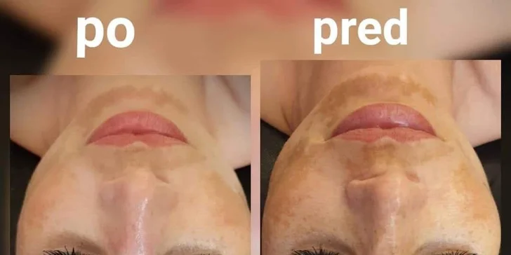 Najvyhľadávanejšie ošetrenie pre krásnu a zjednotenú pleť BB Glow!