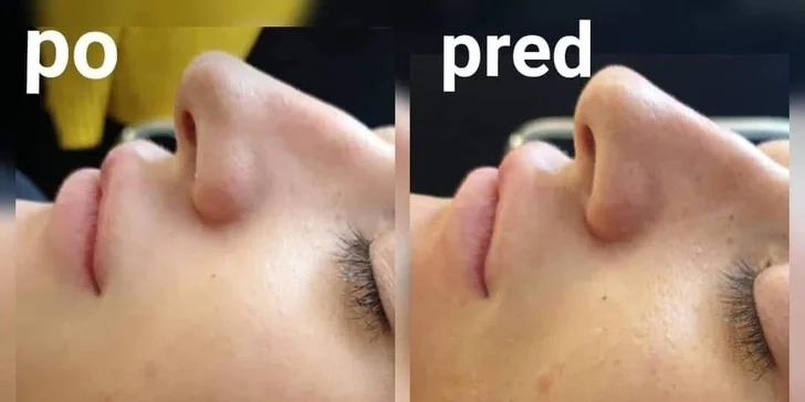 Najvyhľadávanejšie ošetrenie pre krásnu a zjednotenú pleť BB Glow!