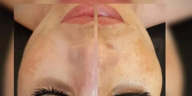 Najvyhľadávanejšie ošetrenie pre krásnu a zjednotenú pleť BB Glow!