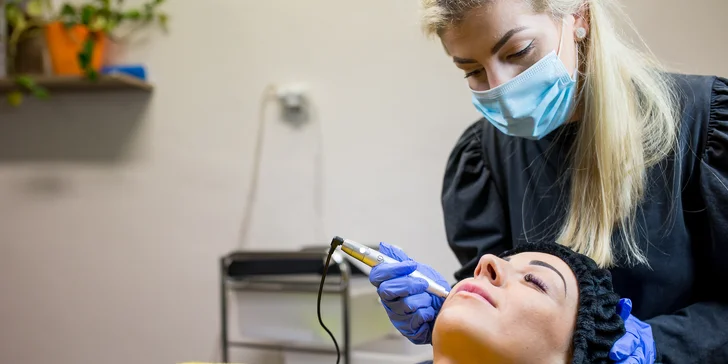 Microneedling alebo Phi-Ion pre odstránenie vrások, akné či zdvihnutie viečok