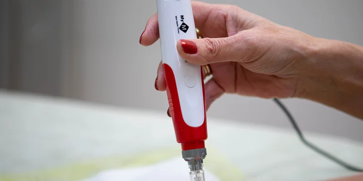 Mezolift - dokonalá hydratácia a revitalizácia pleti