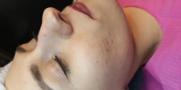 Precízny permanentný make-up obočia čepieľkovou i púdrovou metódou