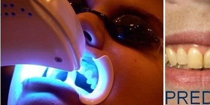 Bielenie zubov bez peroxidu