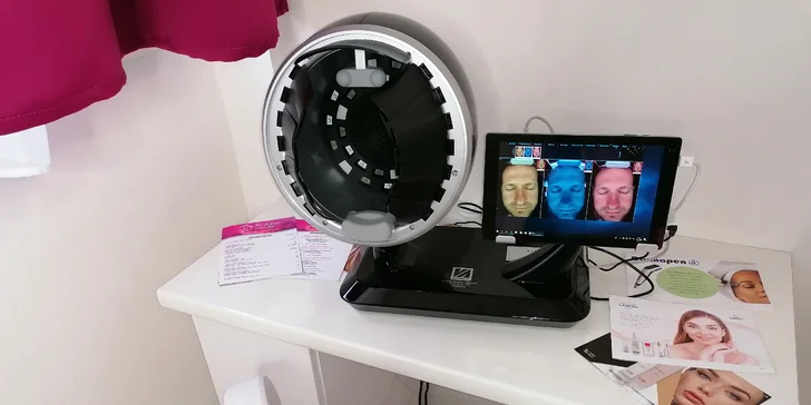 To správne riešenie pre vašu pleť - diagnostika pleti prístrojom Skin analyzér.