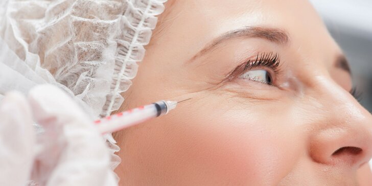 Vyhladenie tváre botoxom: Okolie očí, vráska hnevu, čelo, kútiky či brada