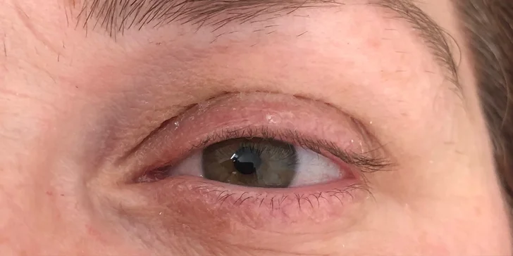 Kompletné balíčky čistenia pleti, 3D mihalnice, laminácia obočia či lash lifting