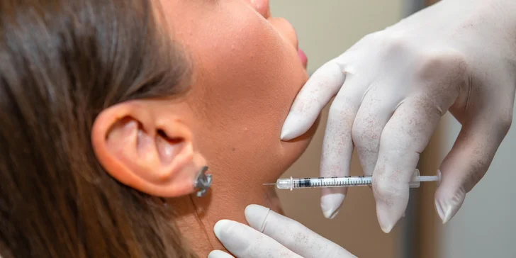 Nefertiti lifting: zúženie dolnej sánky pomocou botulotoxínu