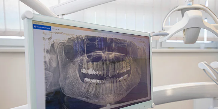 Dentálna hygiena alebo implantologická konzultácia + CT vyšetrenie