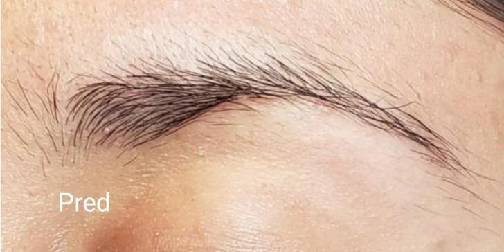 Laminácia obočia v kozmetickom salóne Medica Esthetic