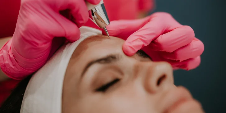 Plazmapen - nová generácia jemnej, neinvazívnej chirurgie proti vráskam