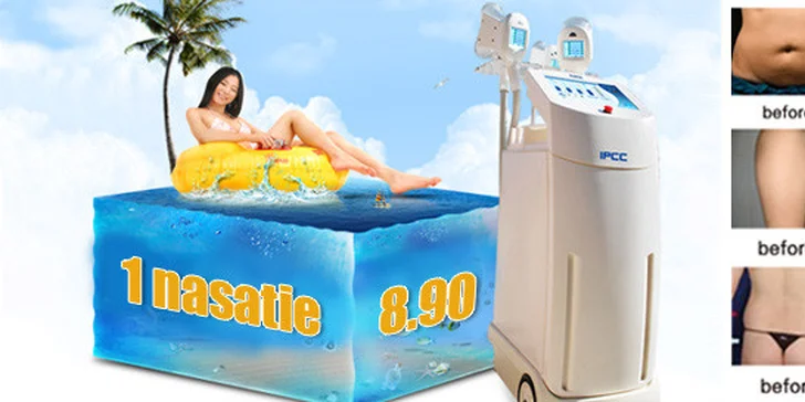 CoolSculpting vákuovou kryolipolýzou