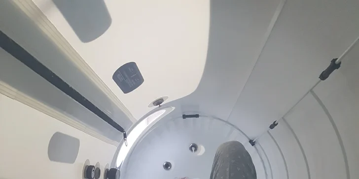 Kyslíková terapia v hyperbarickej komore v OxyMedic