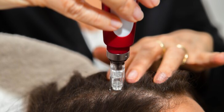 Vlasová mezoterapia a 20 % zľava do kaderníctva BELIEVE