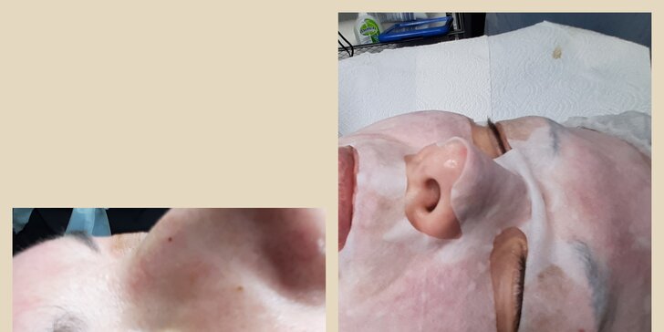 Masáž tváre, hĺbkové čistenie, chemický peeling či anti-age ošetrenie