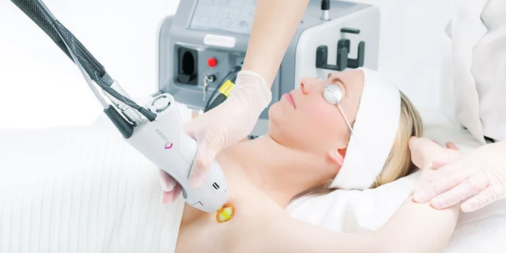 Trvalá epilácia špičkovým medicínskym laserom v zdravotníckom zariadení - bezpečné a efektívne ošetrenie