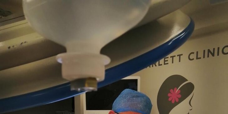 Jednoduchá či kompletná rhinoplastika nosa vykonávaná plastickým chirurgom v Scarlett Clinic