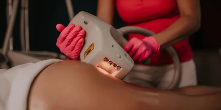 Nechirurgický lifting Fibroblast na Lifting Plazmapen (neinvazívna chirurgia) či darčekové poukazy