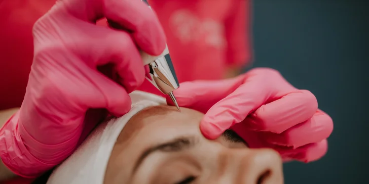 Nechirurgický lifting Fibroblast na Lifting Plazmapen (neinvazívna chirurgia) či darčekové poukazy