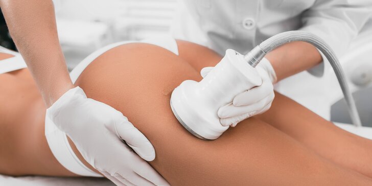 Trvalé odstránenie tuku pomocou ultrazvuku: rôzne časti tela, v ponuke aj výhodná permanentka