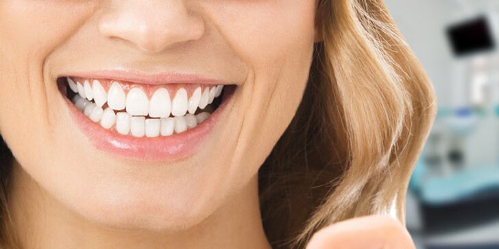 Profesionálne bielenie zubov v stomatologickom centre