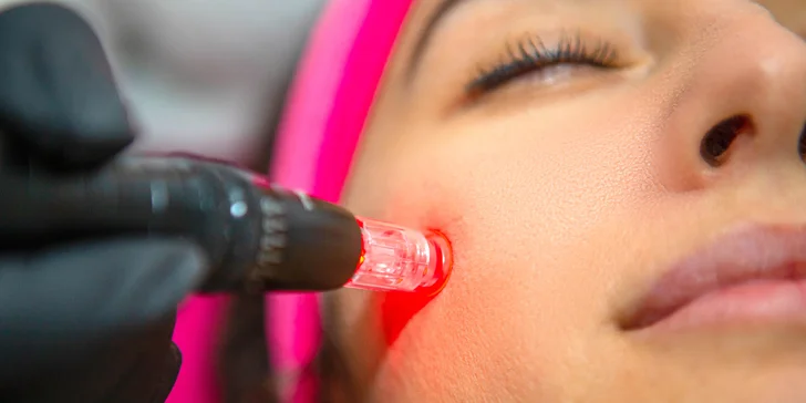 Nádherne žiarivá a zjednotená pleť vďaka ošetreniu BB Glow