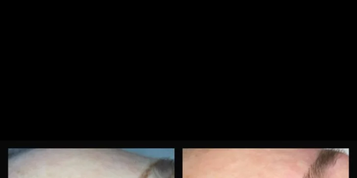 Lash lifting a laminácia, úprava obočia, 3D mihalnice alebo microblading