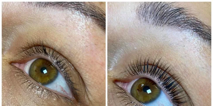 Expresné omladenie pleti a dokonalé mihalnice v Adoreé Beauty