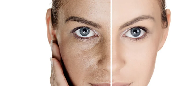 Čistenie pleti "skin scrubber" alebo diamantová dermabrázia s použitím certifikovanej biokozmetiky