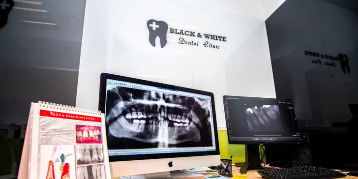 Komplexné vstupné vyšetrenie, dentálna hygiena pre deti i dospelých či bielenie zubov