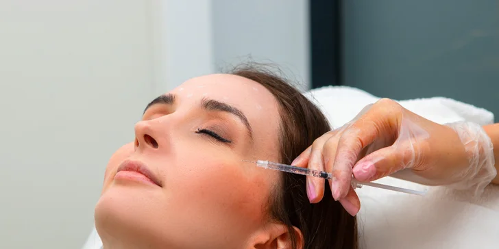 Aplikácia botoxu proti vráskam alebo poteniu v salóne Diva Beauty