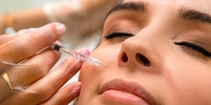Aplikácia botoxu proti vráskam alebo poteniu v salóne Diva Beauty