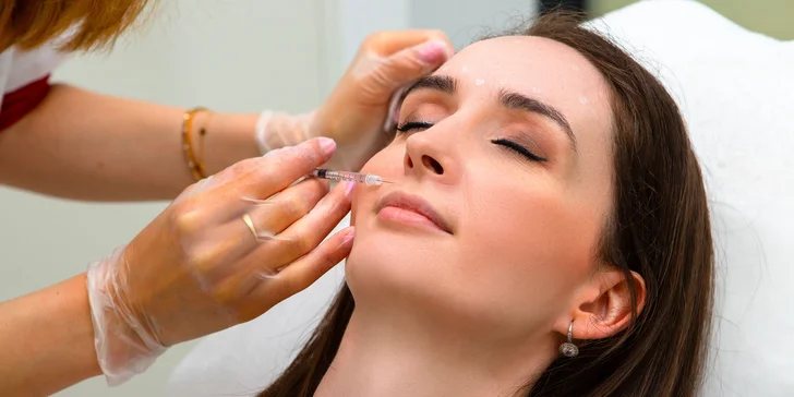 Aplikácia botoxu proti vráskam alebo poteniu v salóne Diva Beauty