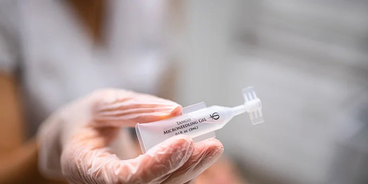 Viditeľné a bezbolestné omladenie pokožky tváre i problémových partií s microneedlingom