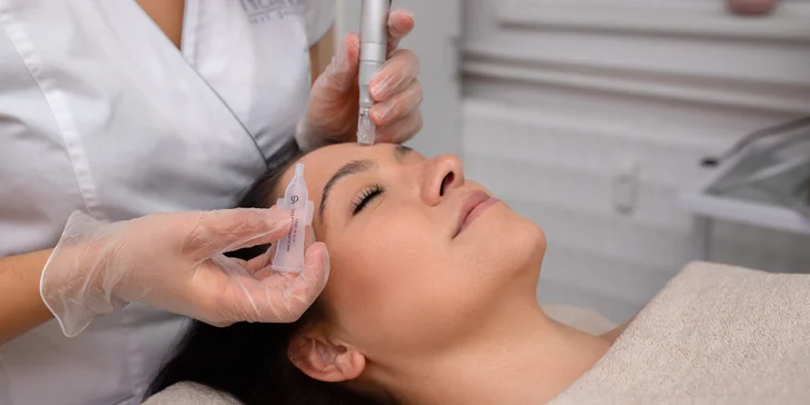 Mezoterapia tváre či vlasov alebo microneedling