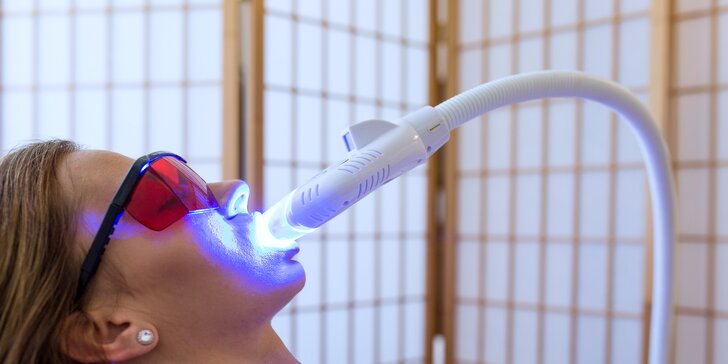 Laserové bielenie zubov v Prestige Esthetics Center v Košiciach