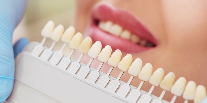 Profesionálne bielenie zubov a dentálna hygiena pre dospelých