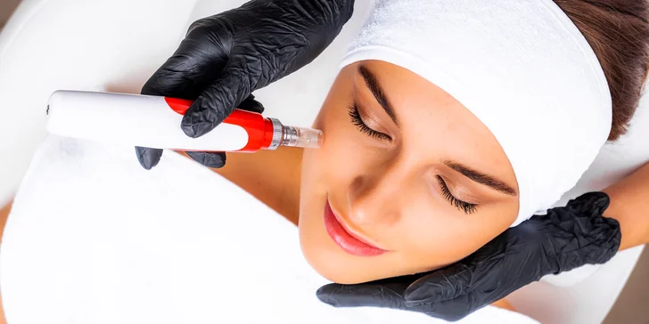 Vysoko účinné ošetrenie pleti - chemický peeling, caviar ANTI-AGE či mezoterapia