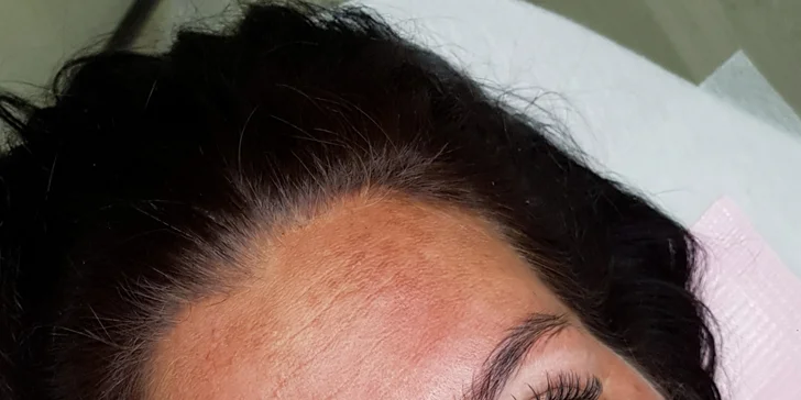 Permanentný make-up obočia, pier či očných liniek alebo odstránenie PMU